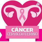 Podcast Cancer de cuello uterino